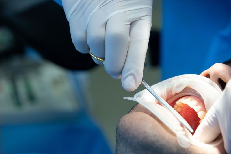 Nowoczesne metody chirurgii stomatologicznej w klinice Dlugosz Dlugosz